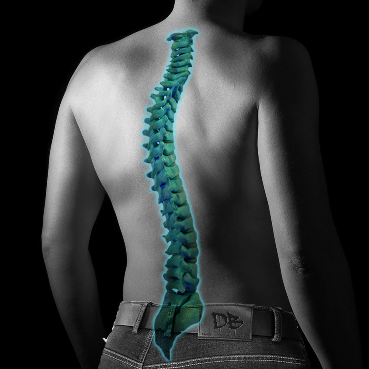Dean Burnetti Law represents victims of spinal cord injuries